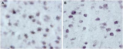 Laminar and Cellular Distribution of Monoamine Receptors in Rat Medial Prefrontal Cortex